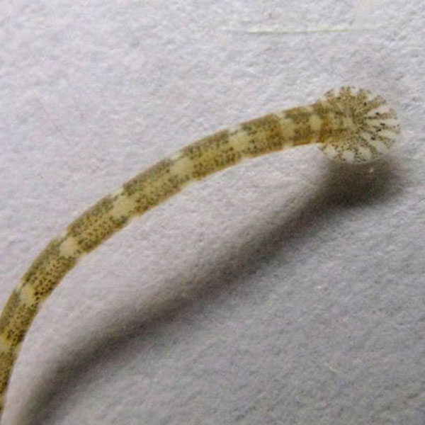 Bệnh do Giun đốt